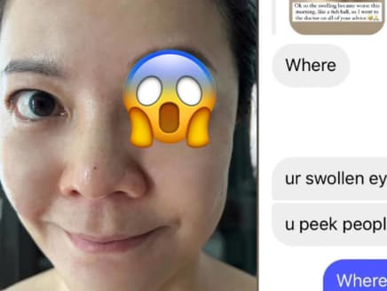 Michelle Chong has a horrifying swollen eye; gives hilarious reply to follower who asked if she peeped at someone in the shower